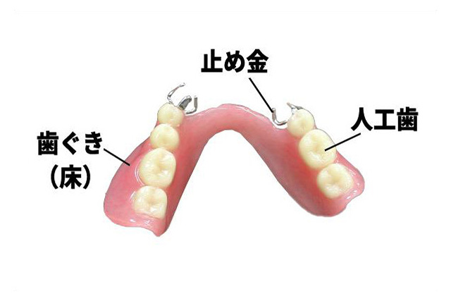 denture03.jpg