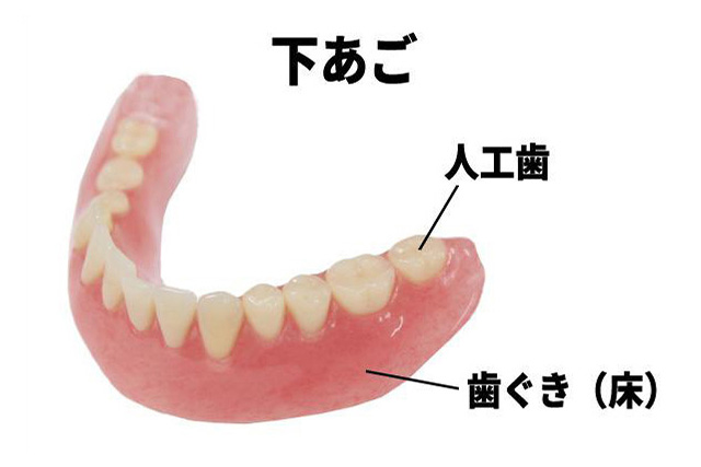 denture02.jpg