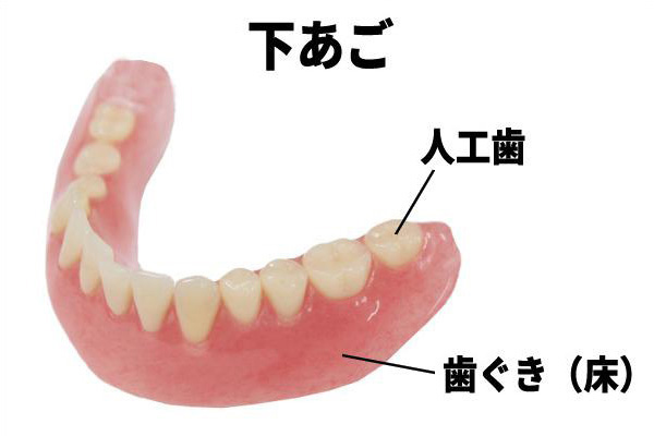 全部床義歯