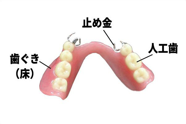 部分床義歯