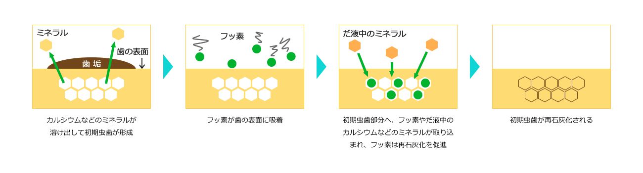 再石灰化の流れのイメージ